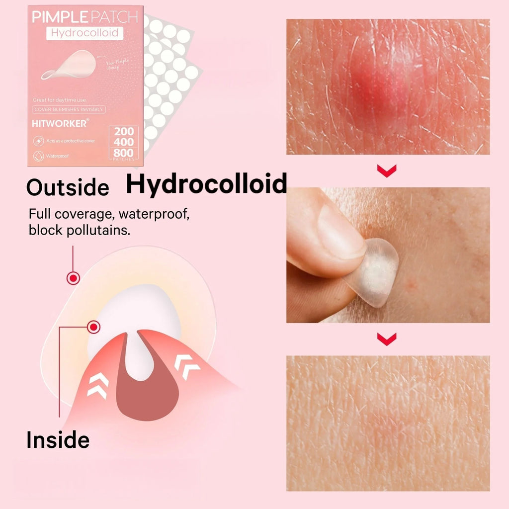 Patchs Anti-Acné Hydrocolloïdes 200/400/800 Pièces - Invisibles, Acide Salicylique & Arbre à Thé
