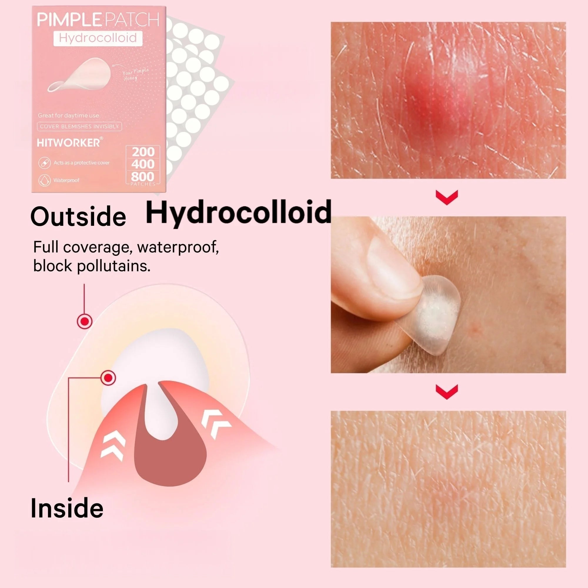 Patchs Anti-Acné Hydrocolloïdes 200/400/800 Pièces - Invisibles, Acide Salicylique & Arbre à Thé