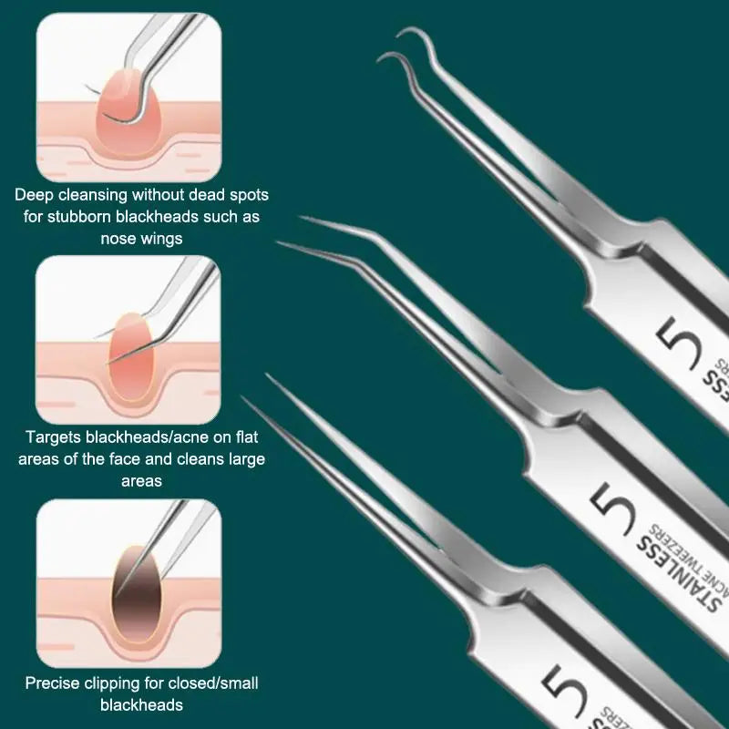 Kit Extracteur de Points Noirs 7/8 Pièces - Outils de Soin de la Peau en Acier Inoxydable